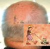 bald_tattoo.jpg