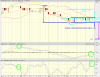 Peninsula Energy Ltd., AU-PEN Advanced Chart - (ASX) AU-PEN, Peninsula Energy Ltd. Stock Price -.png