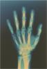 hand_xray.jpg